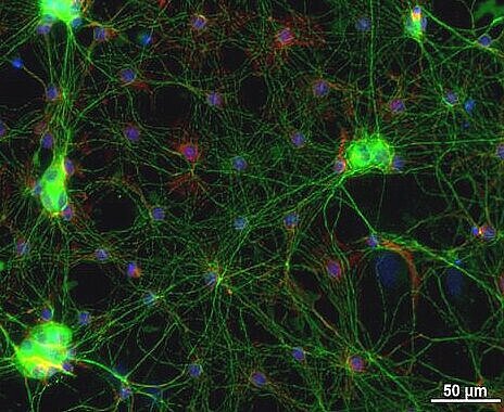 Neuronal networks from the gut